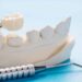 Innovative Approaches to Restorative Dentistry in Everyday Practice