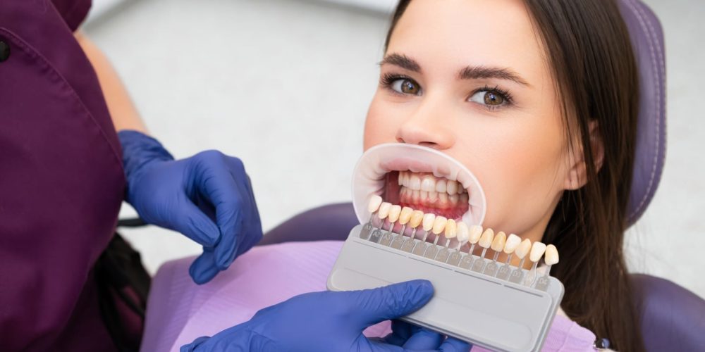 Composite Bonding: Achieving Effortless Elegance in Dental Artistry